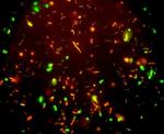 Unikátní mikroskopická fotografie bakterií tzv.Bembekus Fikus (zvětšeno 3000x ). Bakterie jsou původně červené, vlivem zvěšujícího se obsahu alkoholu ve víně však začínají zeleně světélkovat...